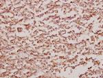 BCKDK Polyclonal Antibody