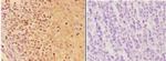 AIRE Polyclonal Antibody
