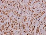 APRIL Polyclonal Antibody