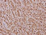 IRF2 Polyclonal Antibody