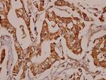 TNFR2 Polyclonal Antibody