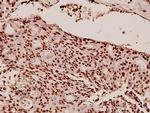 HP1 alpha Polyclonal Antibody