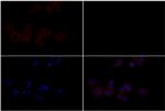 EphB4 Polyclonal Antibody