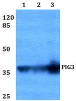 PIG3 Polyclonal Antibody