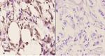 Cdc37 Antibody in Immunohistochemistry (Paraffin) (IHC (P))