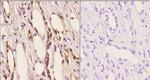 beta Arrestin 1 Polyclonal Antibody