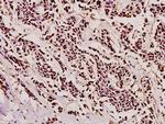 PYCARD Polyclonal Antibody