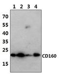 CD160 Polyclonal Antibody
