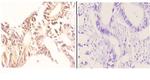 NBS1 Polyclonal Antibody
