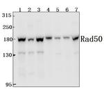 RAD50 Polyclonal Antibody