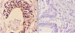 Maspin Antibody in Immunohistochemistry (Paraffin) (IHC (P))