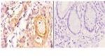 Maspin Polyclonal Antibody