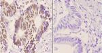 hnRNP C Antibody in Immunohistochemistry (Paraffin) (IHC (P))