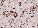 hnRNP A1 Antibody in Immunohistochemistry (Paraffin) (IHC (P))