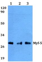 MYF5 Polyclonal Antibody