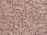 CDK2 Polyclonal Antibody