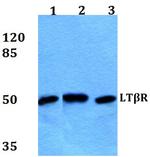 LTBR Polyclonal Antibody