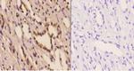 PFKP Polyclonal Antibody