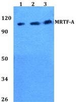MKL1 Polyclonal Antibody