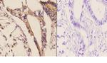CDH17 Polyclonal Antibody