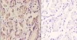 DAP5 Polyclonal Antibody