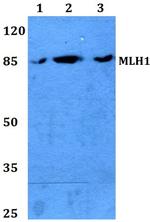 MLH1 Polyclonal Antibody