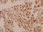 p73 Polyclonal Antibody
