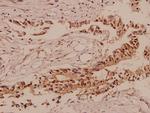 TCF3 Polyclonal Antibody
