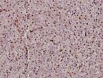 Bax Antibody in Immunohistochemistry (Paraffin) (IHC (P))