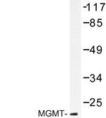 MGMT Antibody in Western Blot (WB)