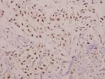 C/EBP gamma Polyclonal Antibody