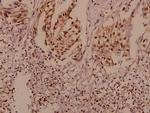 P-cadherin Polyclonal Antibody