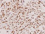 TACC3 Antibody in Immunohistochemistry (Paraffin) (IHC (P))