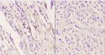 Apelin Receptor Polyclonal Antibody