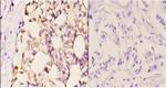 beta-2 Adrenergic Receptor Antibody in Immunohistochemistry (Paraffin) (IHC (P))