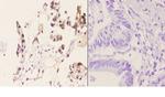 beta-2 Adrenergic Receptor Antibody in Immunohistochemistry (Paraffin) (IHC (P))