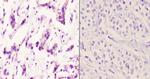 beta-2 Adrenergic Receptor Antibody in Immunohistochemistry (Paraffin) (IHC (P))