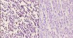 IRF4 Polyclonal Antibody