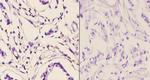 PMS2 Antibody in Immunohistochemistry (Paraffin) (IHC (P))