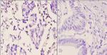 PMS2 Antibody in Immunohistochemistry (Paraffin) (IHC (P))