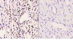 PMS2 Polyclonal Antibody