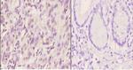 Ku80 Polyclonal Antibody