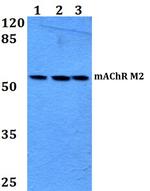 CHRM2 Polyclonal Antibody
