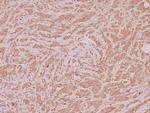 PPT1 Polyclonal Antibody