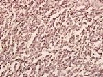 PFKP Polyclonal Antibody