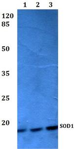 SOD1 Polyclonal Antibody