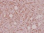 VIP Polyclonal Antibody