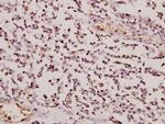 GCLM Polyclonal Antibody