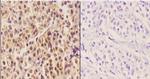 HNF4A Polyclonal Antibody