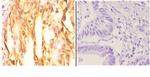 AKT1 Antibody in Immunohistochemistry (Paraffin) (IHC (P))